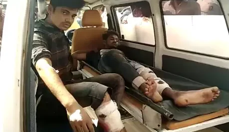 पुलिस और बदमाशों के बीच हुई मुठभेड़ में 50-50 हजार के दो इनामी बदमाश घायल