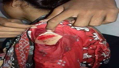 ब्लेड मैन ने मचाया उत्पात,20 महिलाओं को मेले में किया जख्मी