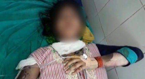 बलात्कार से बचने के लिए छात्रा ने तीसरी मंजिल से लगाईं छलांग हाई टेंशन तार की चपेट में आई