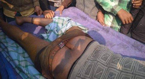 दबंग पुलिस ने की जमकर युवक की पिटाई,अधिकारीयों ने दिया कार्यवाही का आश्वासन