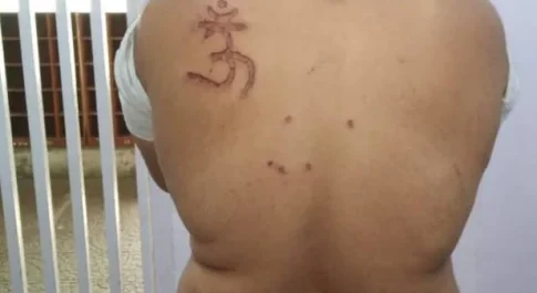 तिहाड़ जेल के अधीक्षक ने मुस्लिम कैदी की पीठ पर गोदकर लिखा ‘ओम’