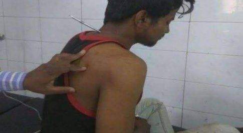 30 वर्षीय युवक की गर्दन में घूंसा पेचकस, देख कर लोग हुए हैरान 