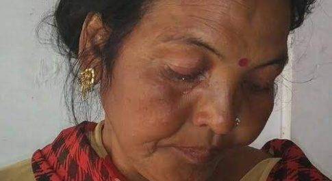 महराजगंज। स्वास्थ्यकर्मी आशा के साथ दबंगों ने किया बदसलूकी