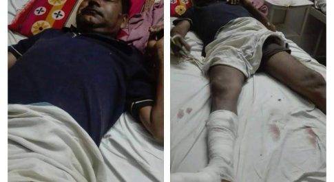 लखीमपुर खीरी| दो मोटर साइकिल का आमने सामने से हुई टक्कर एक घायल टक्कर मारने वाला मौके से फरार