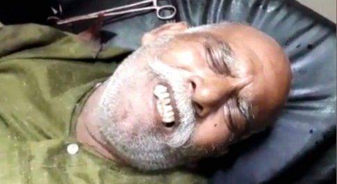 पुरानी रंजिश में दिनदहाड़े कार सवार बदमाशों ने अधेड़ को मारी गोली