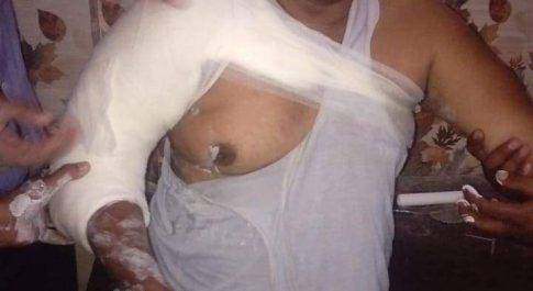 महराजगंज। सडक़ हादसे में बृजमनगंज ब्लाक के ग्राम सचिव हुए घायल