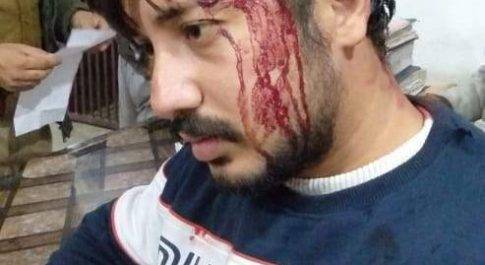 लखीमपुर खीरी। बीती रात सिंगाही मेले में व्यापार मंडल अध्यक्ष व भारतीय जनता युवा पर हमला हुआ