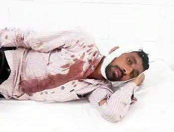 पीलीभीत। फसल में आग लगाने को लेकर पीलीभीत और शाहजहांपुर के ग्रामीणों में संघर्ष