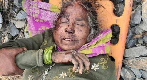 महराजगंज। रेलवे क्रॉसिंग पार करते हुए ट्रेन की चपेट में आने से अज्ञात महिला हुई जख्मी