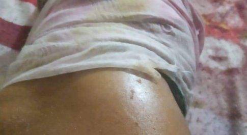फरेंदा। बाइक की ठोकर से पत्रकार घायल