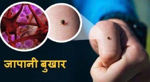महाराजगंज। जेई/ एईएस के मामले में चिन्हित है 37 ग्राम पंचायतें