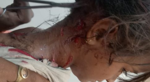 तेंदुआ ने हमला कर बच्ची को किया घायल बच्ची का प्राइवेट नर्सिंग होम में चल रहा है इलाज