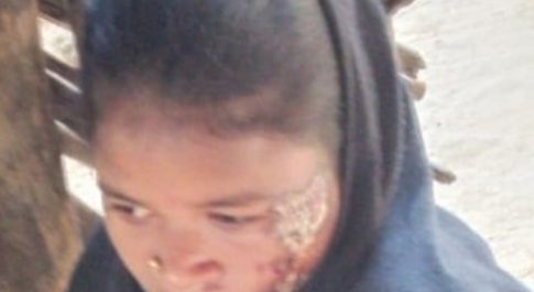 बस्तर के बुर्जी और कुंदेड़ में पुलिस कैंप का विरोध कर रहे आदिवासियों पर पुलिस के हमले की किसान सभा ने की निंदा, कहा : दोषियों को गिरफ्तार करो, घायलों को मुफ्त चिकित्सा और मुआवजा दो